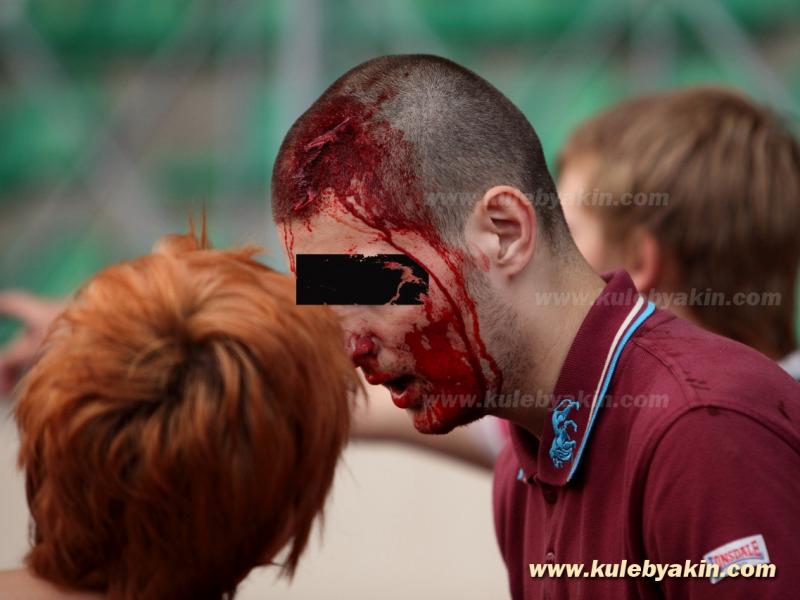 Ein verletzter Antifaschist in Pushkin 6