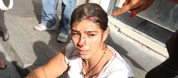 Noch eine von den Bullen verletzte Aktivistin